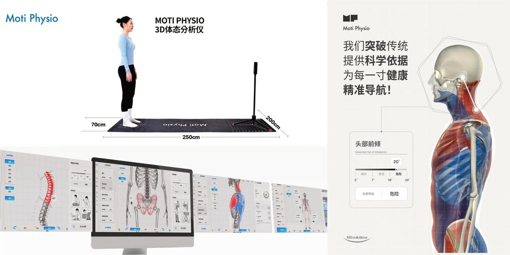Moti Physio 3D体态分析仪与评估界面